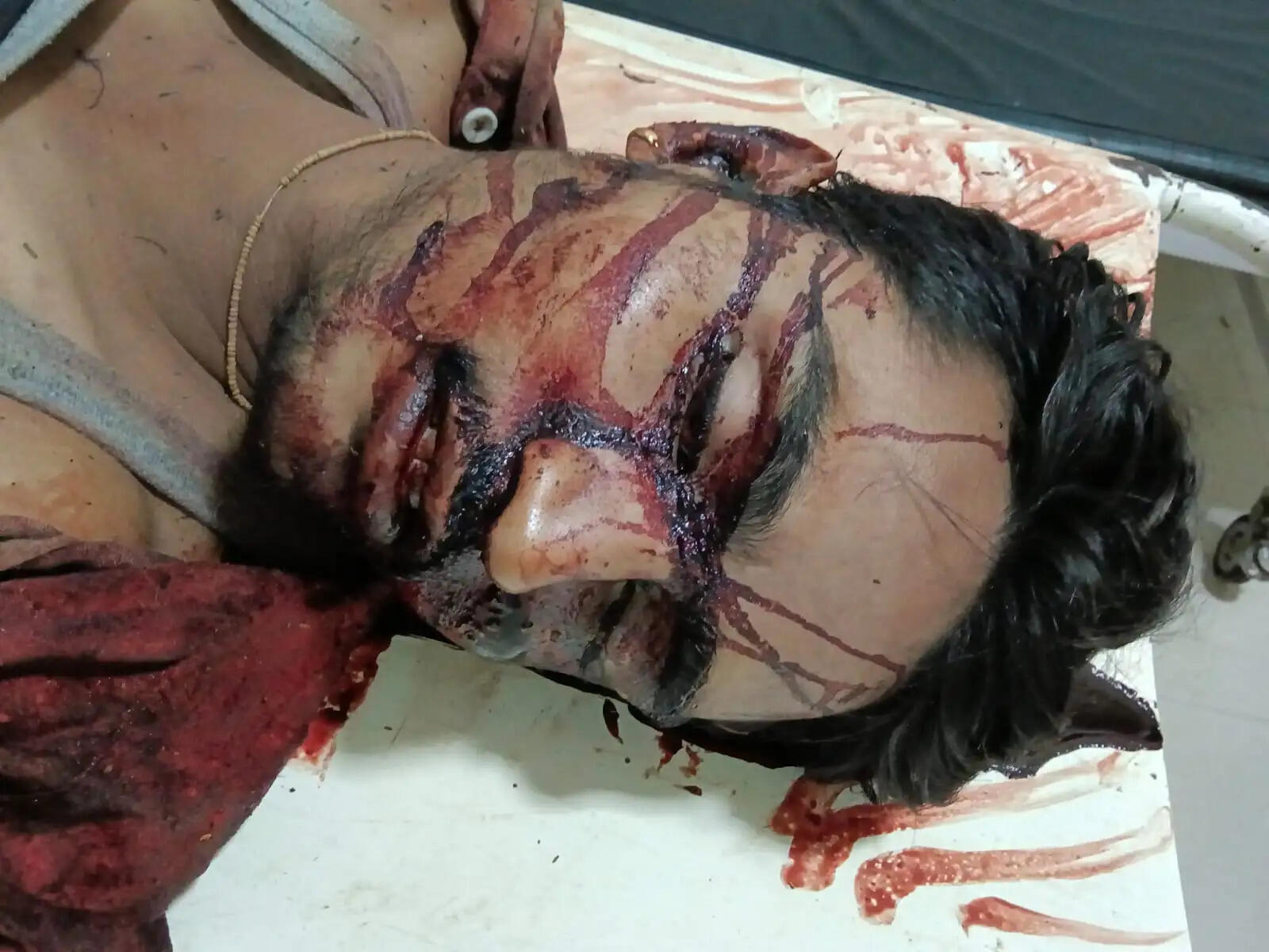 राजगढ़ः बारात में नाचते समय भगदड़, तीन युवक कुएं में गिरे, एक की मौत, दो घायल