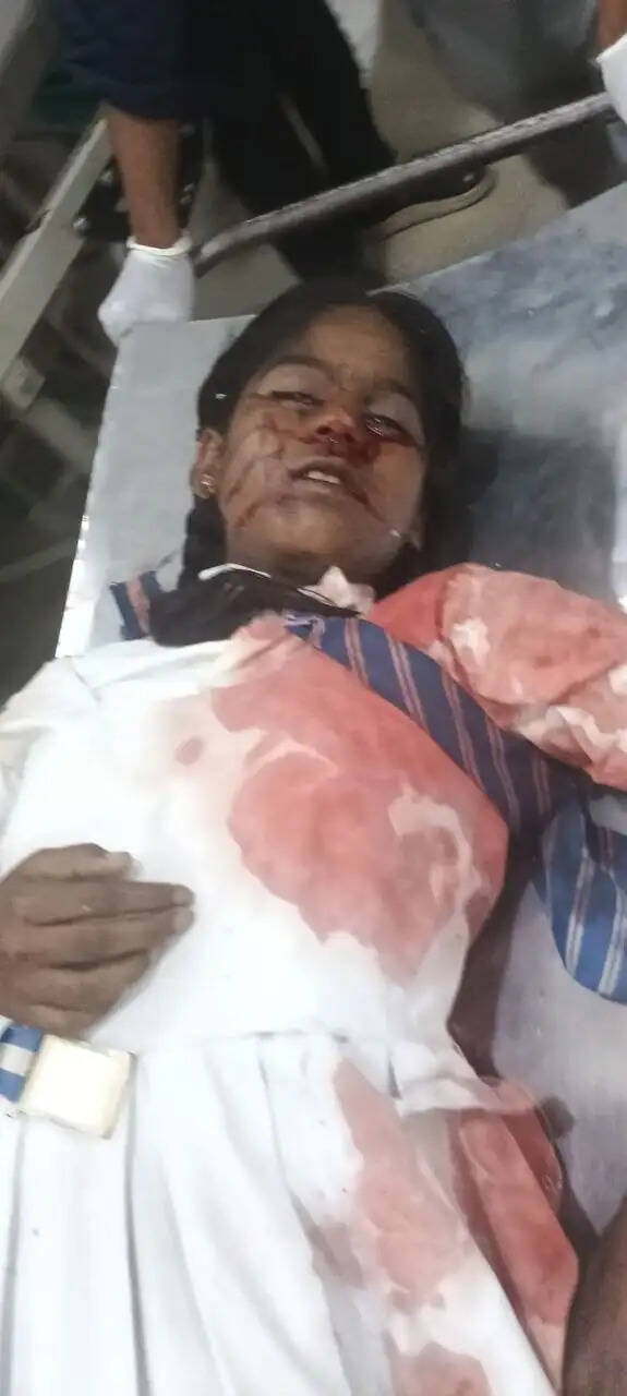 दमोह में तेज रफ्तार बस ने तीन छात्राओं को रौंदा, दो की मौत, एक गंभीर