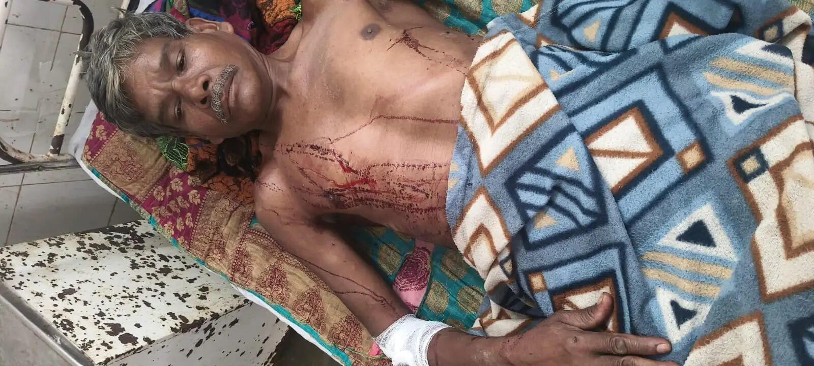 बैल का शिकार करने गांव पहुंचा तेंदुआ, हमले में मेहमान और पड़ोसी सहित तीन घायल