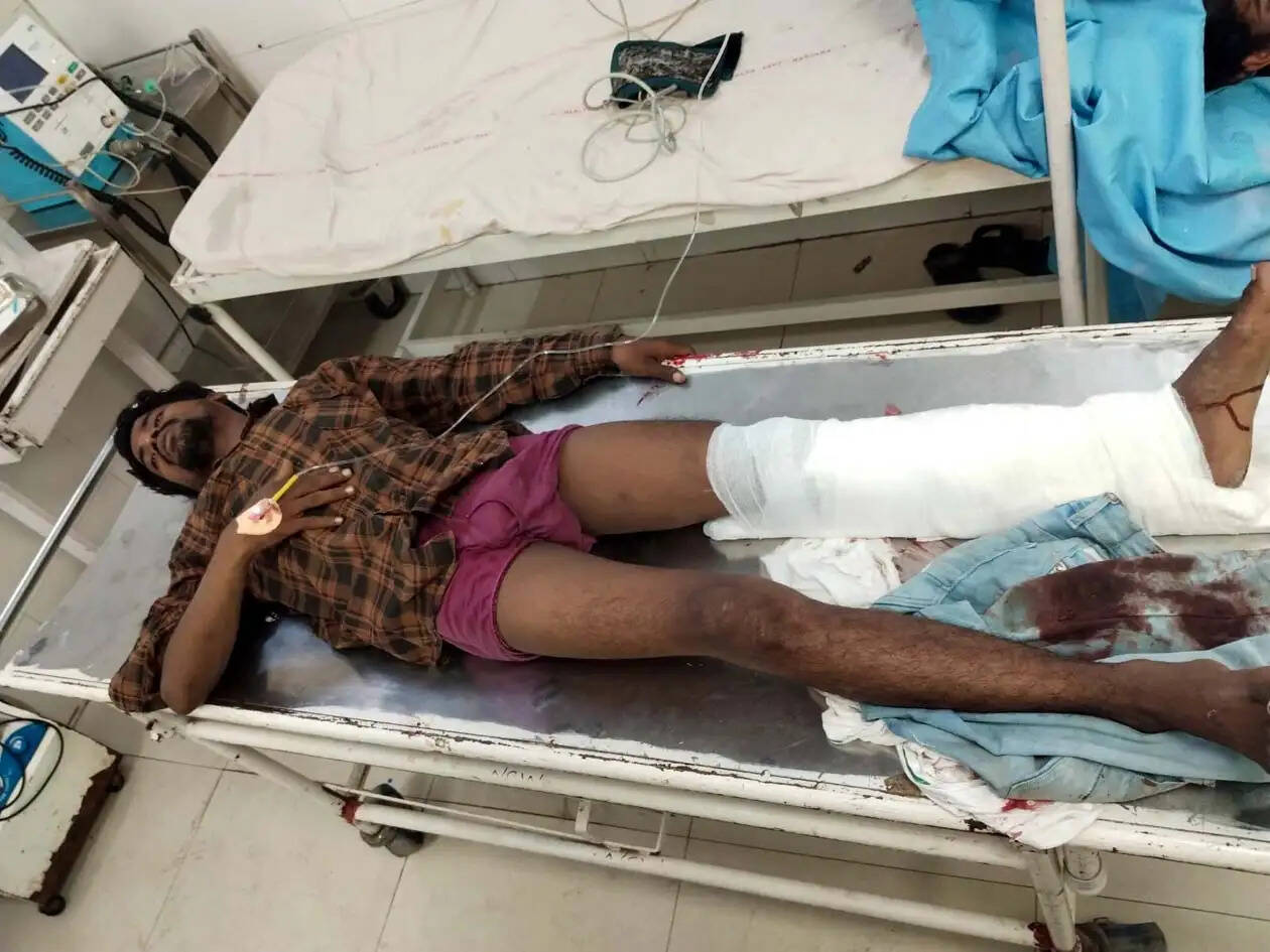 हिसार पुलिस ने मुठभेड़ में पकड़े तीन बदमाश, दो के पैर में लगी गोली
