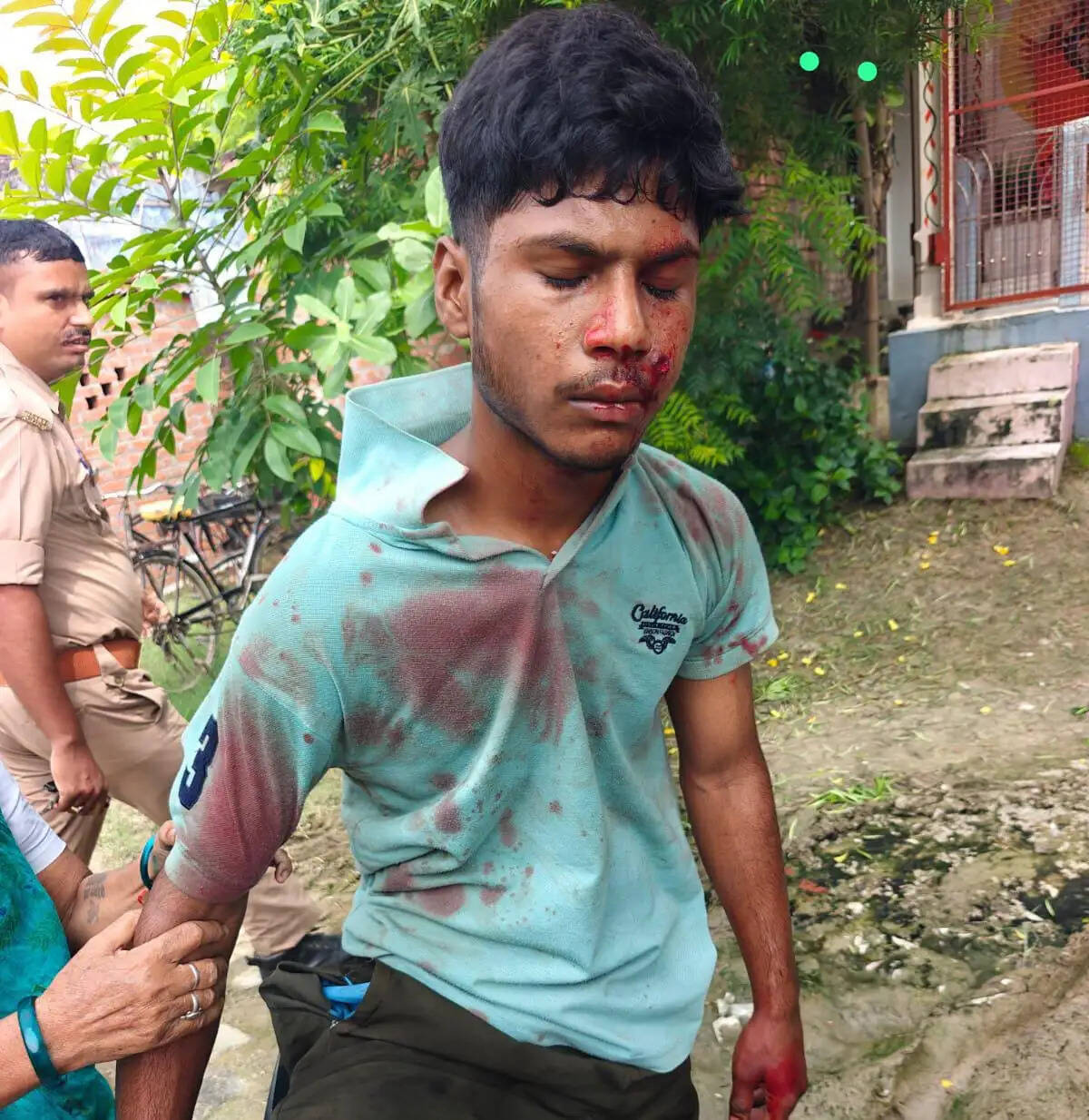 वाराणसी : दोस्तों के साथ रील बनाते समय अवैध पिस्टल से चली गोली, हुआ लहूलुहान