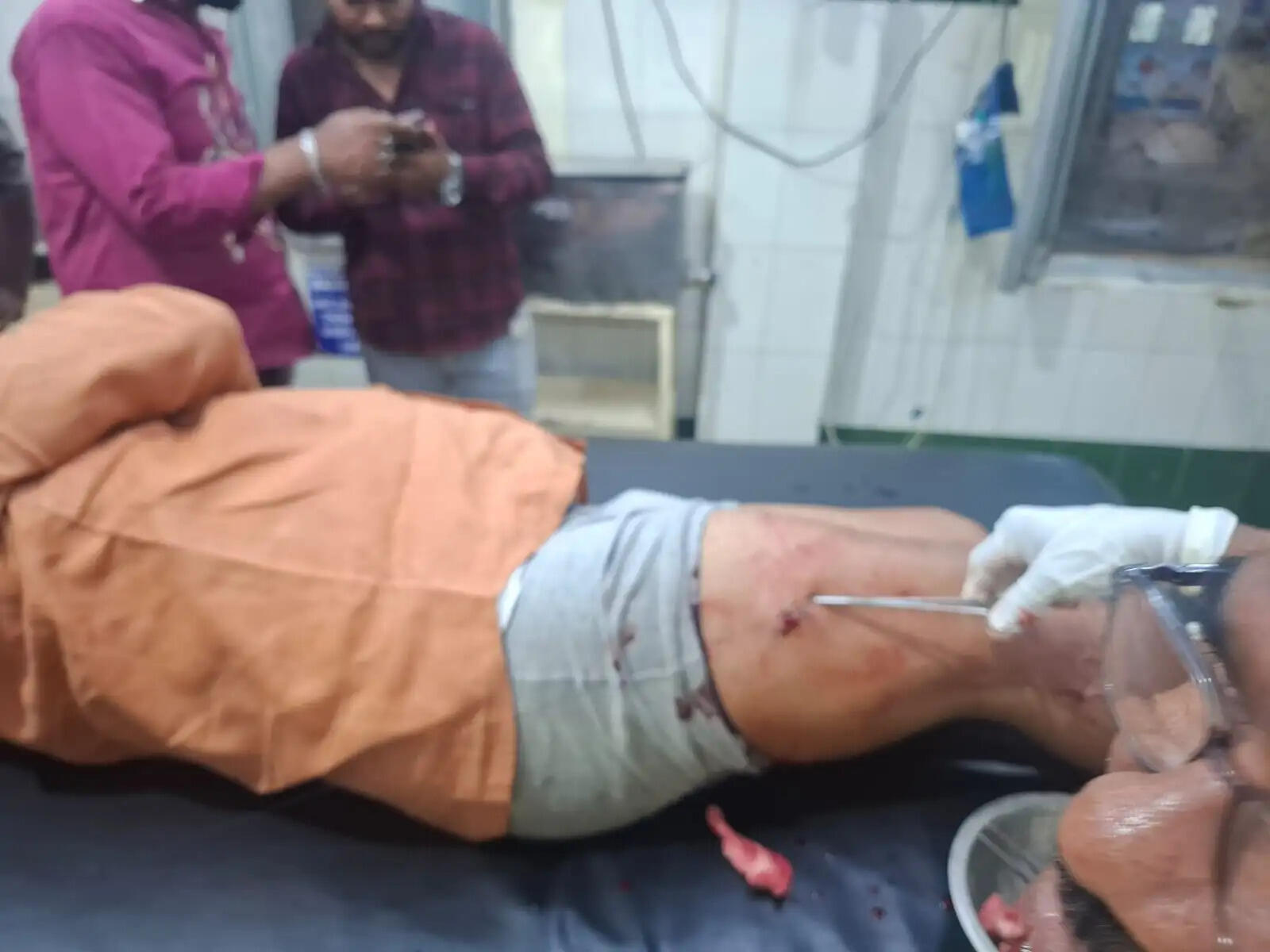 जबलपुर में भाजपा के पूर्व मंडल अध्यक्ष पर चाकू से जानलेवा हमला, दोनों जांघों में लगे वार