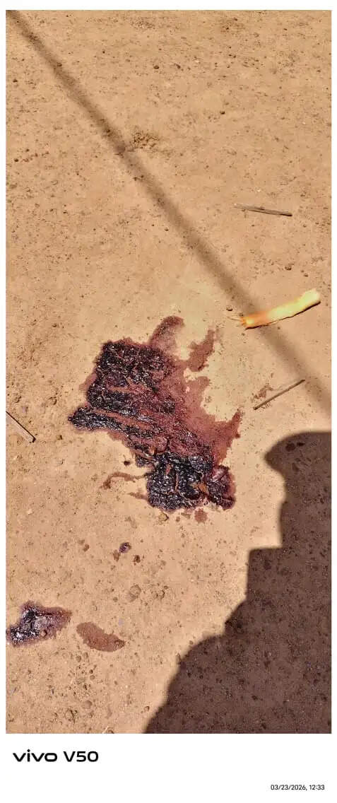 पामगढ़ में विवाद के दौरान चली गोली, युवक घायल, दो आरोपित हिरासत में