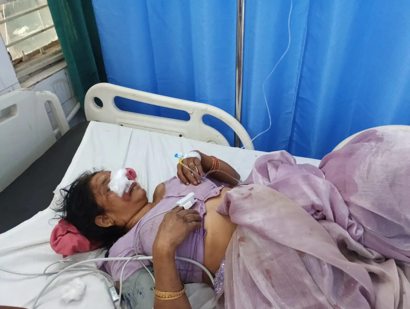 अनूपपुर: कार ने बाइक को मारी टक्कर, दो महिलाएं घायल, कार सवार हुए फरार