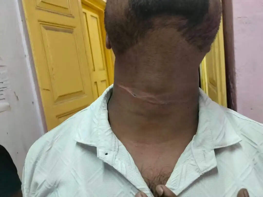 उत्तरपाड़ा में फिर चीनी मांझे की चपेट में आया युवक, बाल-बाल बची जान