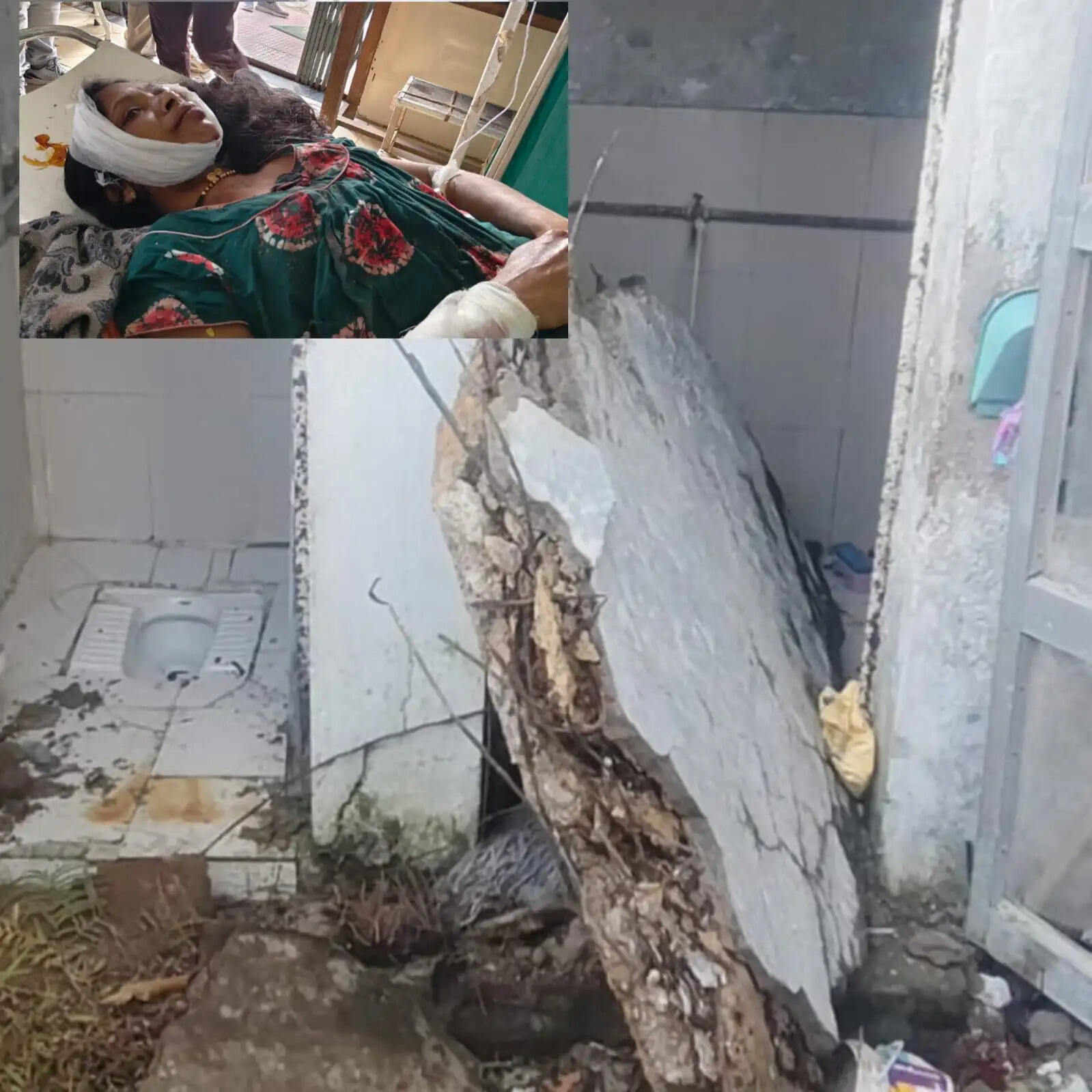 अनूपपुर: राजनगर कॉलरी के डबल स्टोरी का गिरा छज्जा, बर्तन साफ कर रही महिला घायल