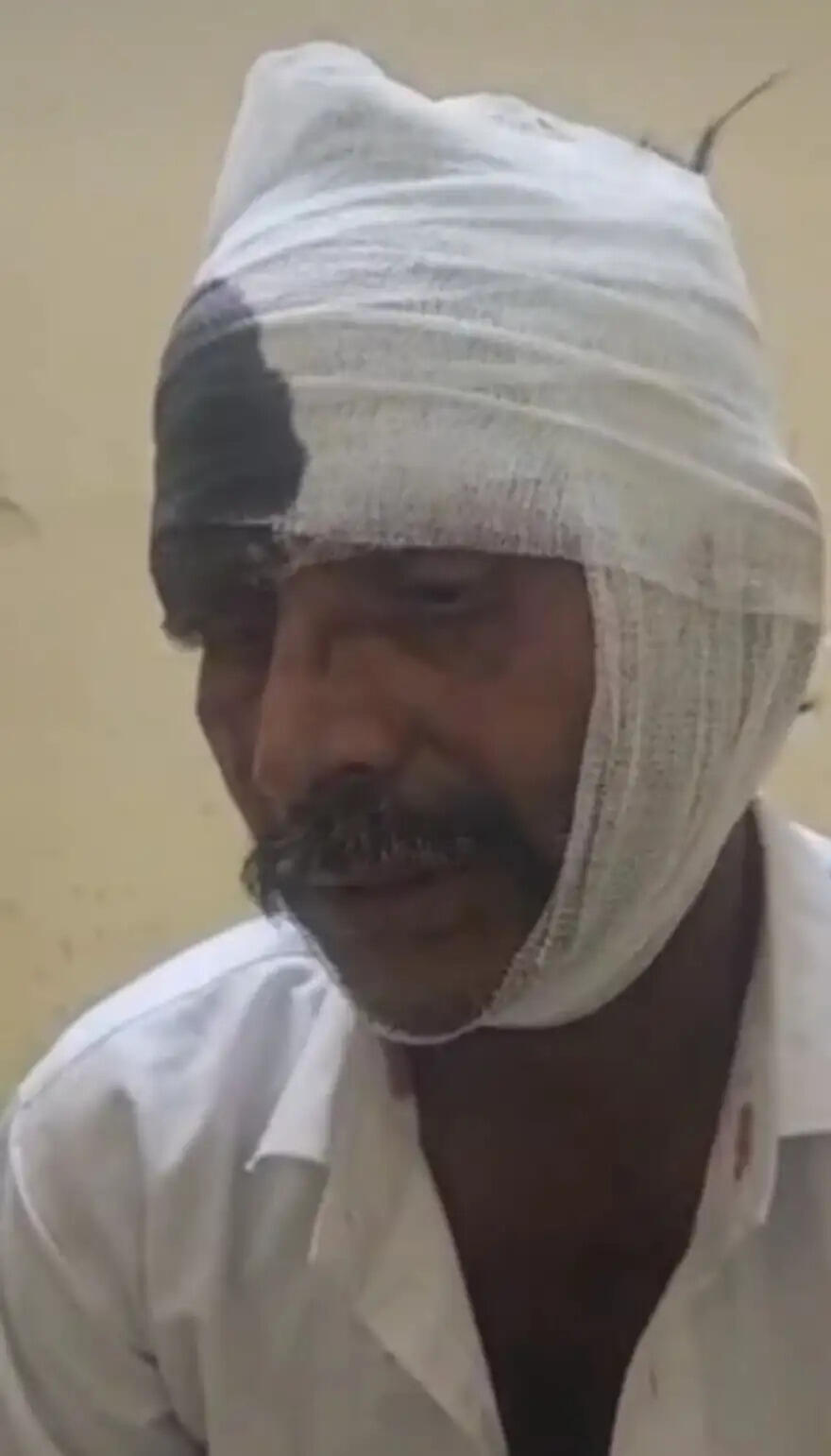 मुंडन से लौट रही ट्रैक्टर ट्राली खाईं में गिरी, 20 घायल चार की हालत गंभीर