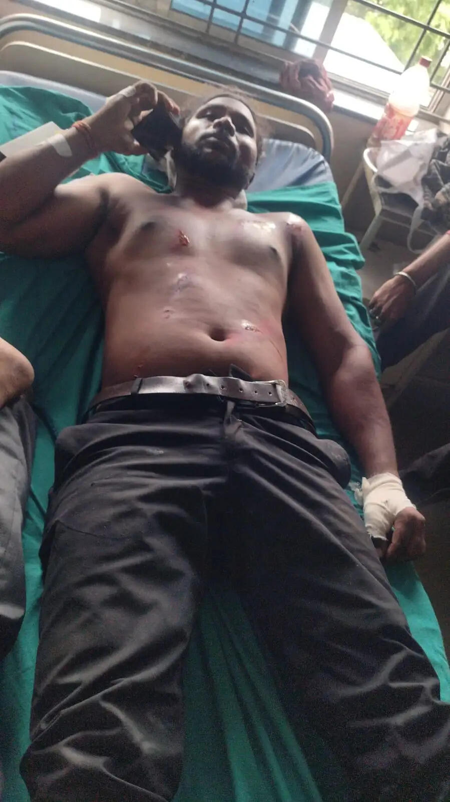 पूर्व पार्षद संजय नोनिया पर भाजपा कार्यकर्ता और उसके परिवार पर हमले का आरोप