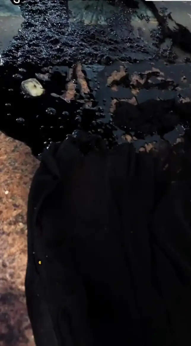 गुरुग्राम अस्पताल में इलाज करवाने आई महिला पर फेंका ज्वलनशील पदार्थ, आरोपी काबू