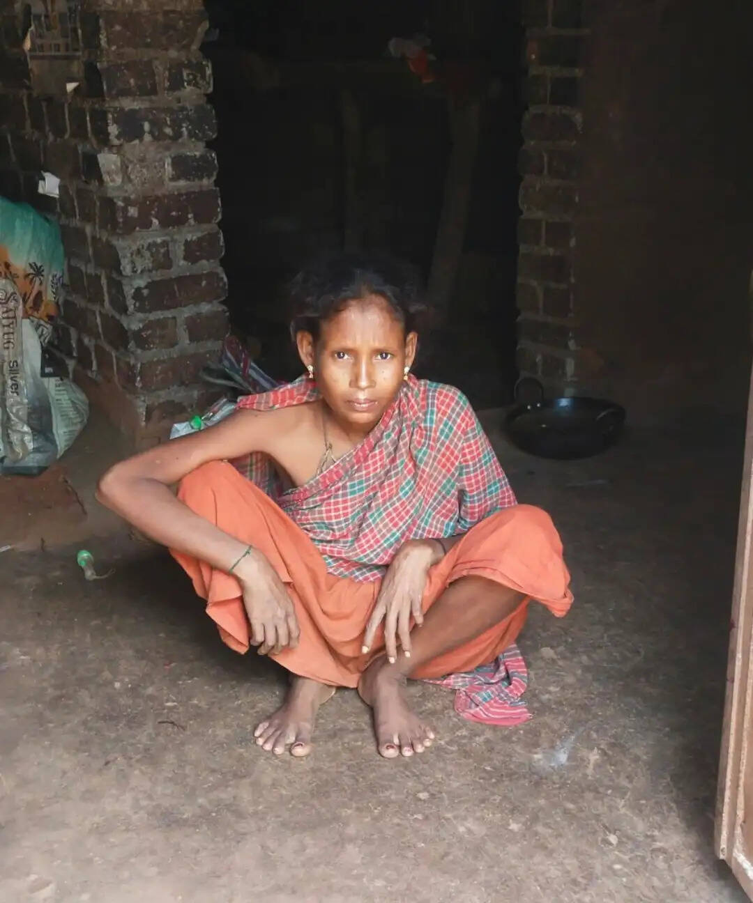 दस साल से रेंगकर चलने को मजबूर लुगरी, इलाज और सरकारी मदद की आस, जांच दल भेजेगा प्रशासन