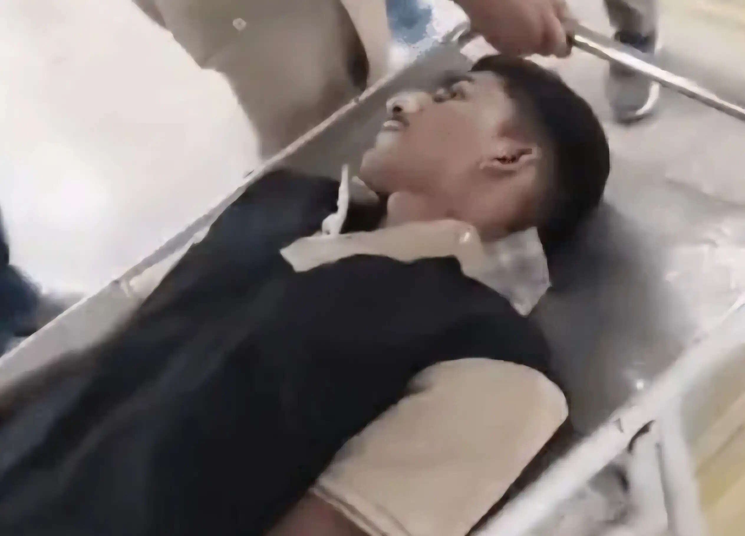 यमुनानगर:फायरिंग कांड का आरोपी हिरासत से कूदा, पुलिस कार्रवाई के दौरान हुआ घायल