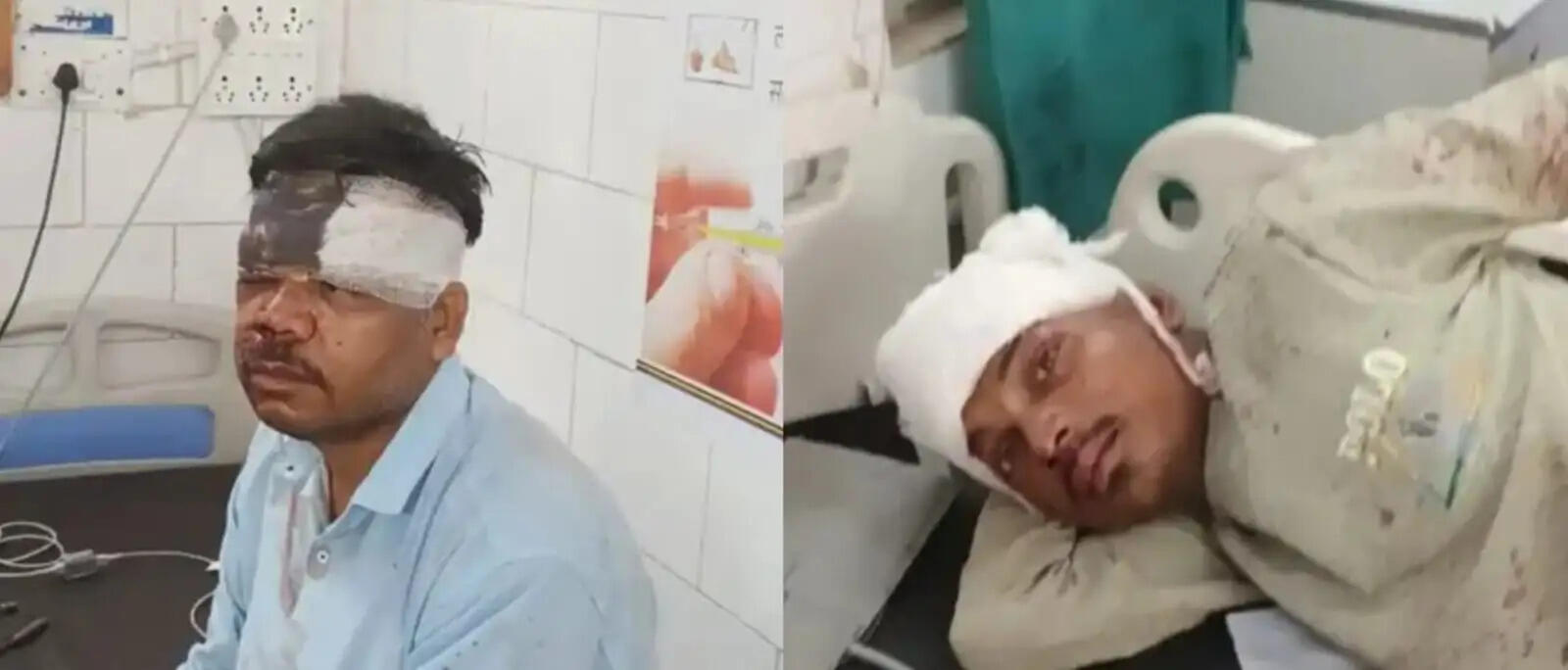 अनूपपुर: ऑटो ने बाइक की आमन-सामने की टक्कर,दोनों चालक गंभीर घायल