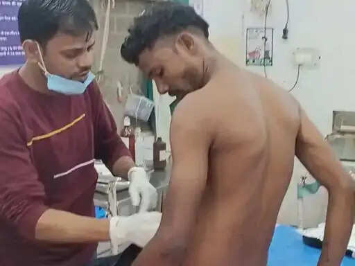 अनूपपुर: सड़क पर लड़ रहे मवेशी से बाइक चवार युवक से टकराया, कंधे की हड्डी टूटी