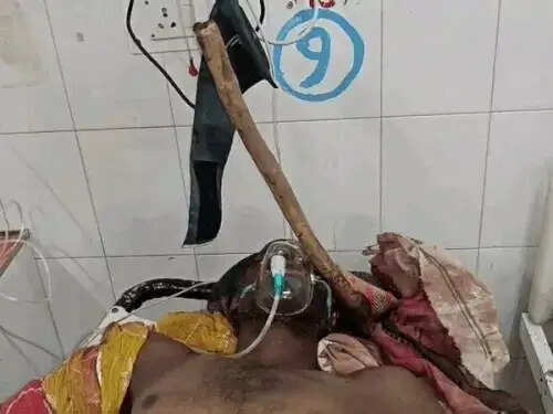 सोते युवक पर कुल्हाड़ी से जानलेवा हमला, सिर में धंसा हथियार; गंभीर हालत में कोटा रेफर