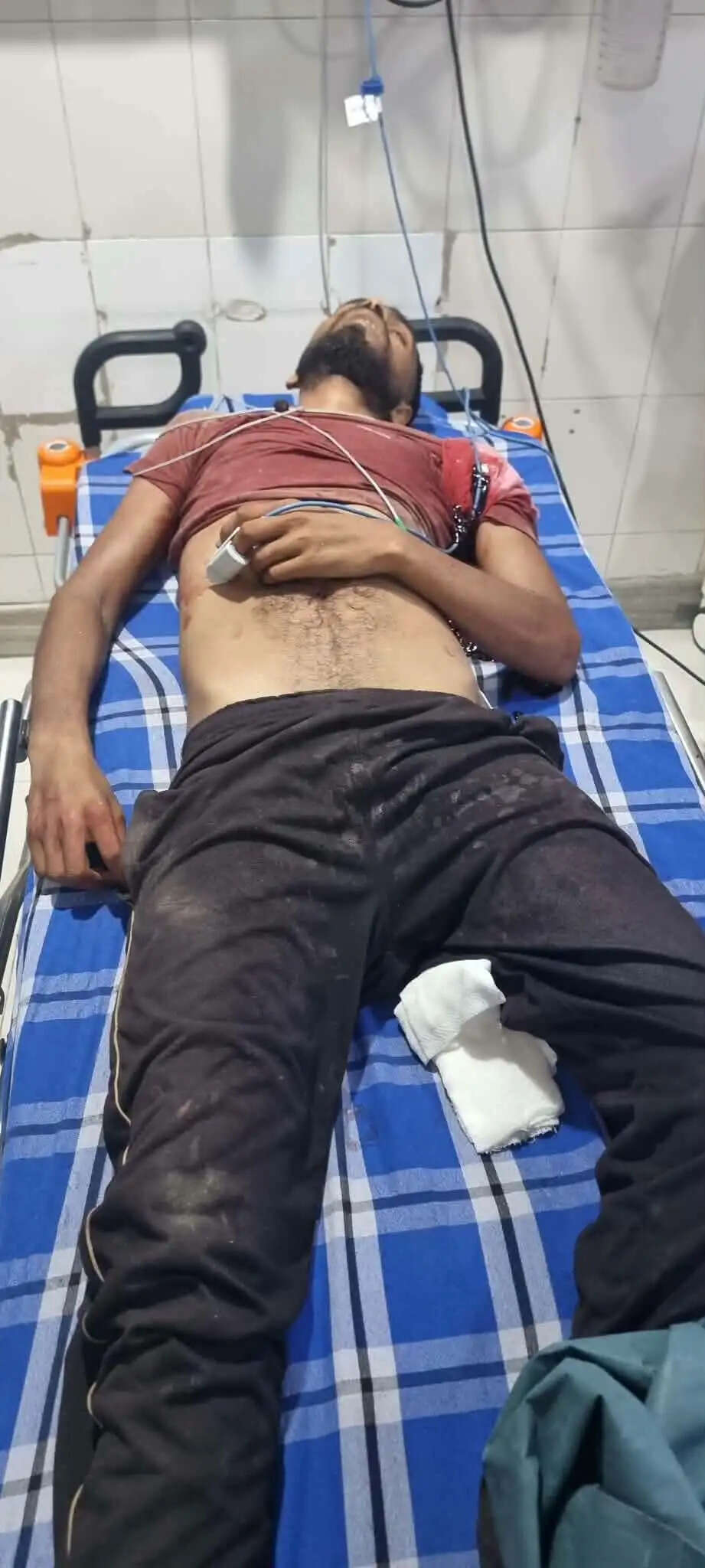 बोलबम यात्रा निकालने को लेकर दूसरे समुदाय के आपत्ति पर विवाद,पुलिस की गोली से एक युवक की मौत 9 घायल,लगा कर्फ्यू