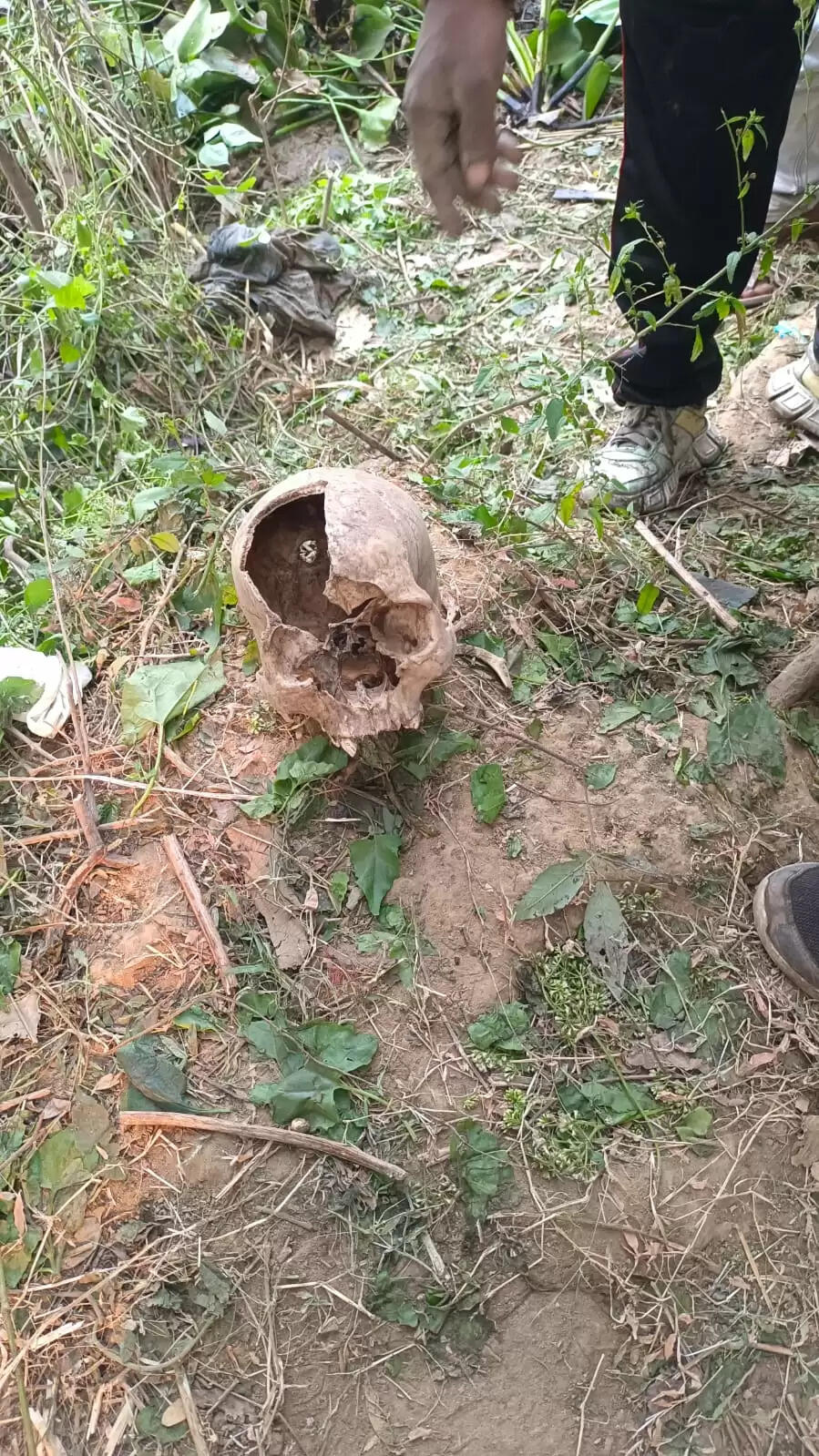 सोनू राम को सिर के पीछे मारी गई थी गोली