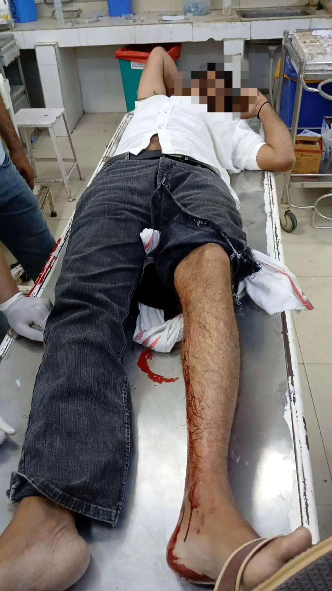 हिसार पुलिस ने मुठभेड़ में दाे बदमाश दबाेचे, एक के पैर में लगी गोली
