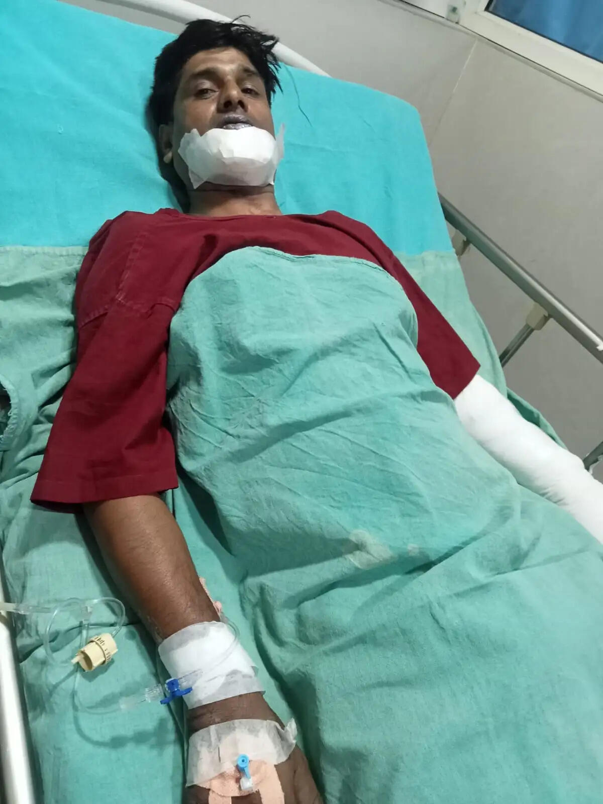 विद्युतकर्मी की दुघर्टना पर श्रमिक संघ आक्रोशित, उच्चस्तरीय जांच और सख्त कार्रवाई की मांग