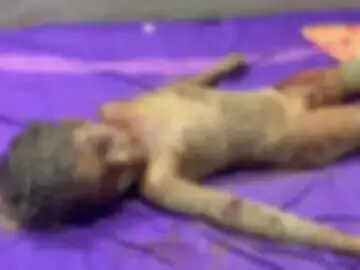 कोरबा में आवारा कुत्तों के हमले में पांच वर्षीय मासूम की मौत, आयुक्त ने पीड़ित परिवार से की मुलाकात