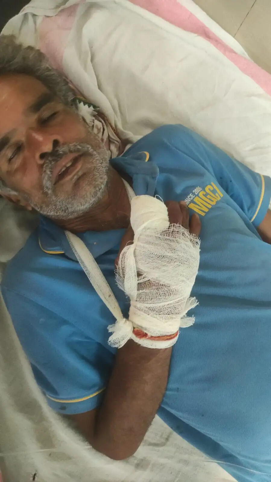 दमोह: रंजिश में किसान पर कुल्हाड़ी से हमला, दो उंगलियां कटीं