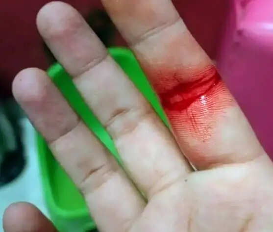 दहेज के लिए ससुरालियों ने विवाहिता को पीटा, पति समेत पर 6 पर मुकदमा दर्ज