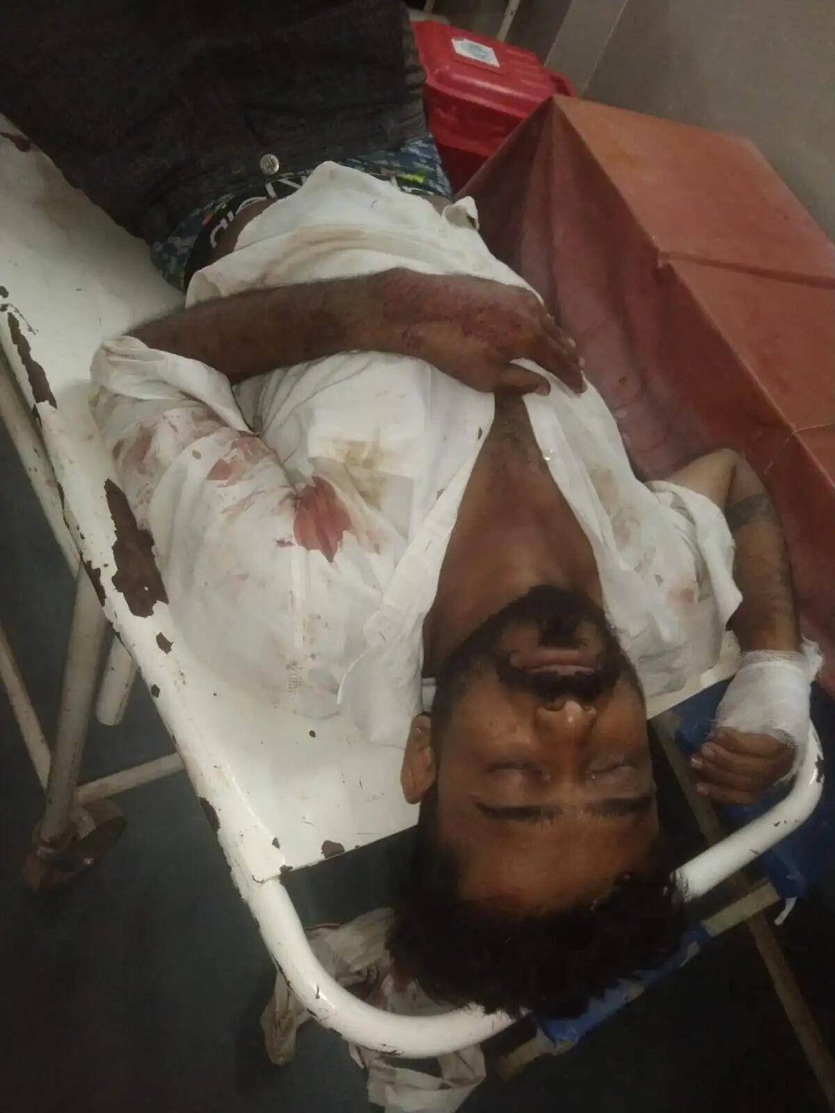 धमतरी के&nbsp;मुजगहन&nbsp;&nbsp;में चाकूबाजी, पूर्व सरपंच के बेटे की मौत, साथी गंभीर