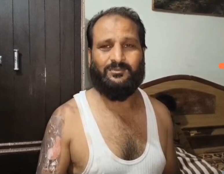 कानपुर : बच्चे को थप्पड़ मारने का विरोध करने पर परिवार पर फेंकी खौलती चाय, दादी, पिता और भाई झुलसे