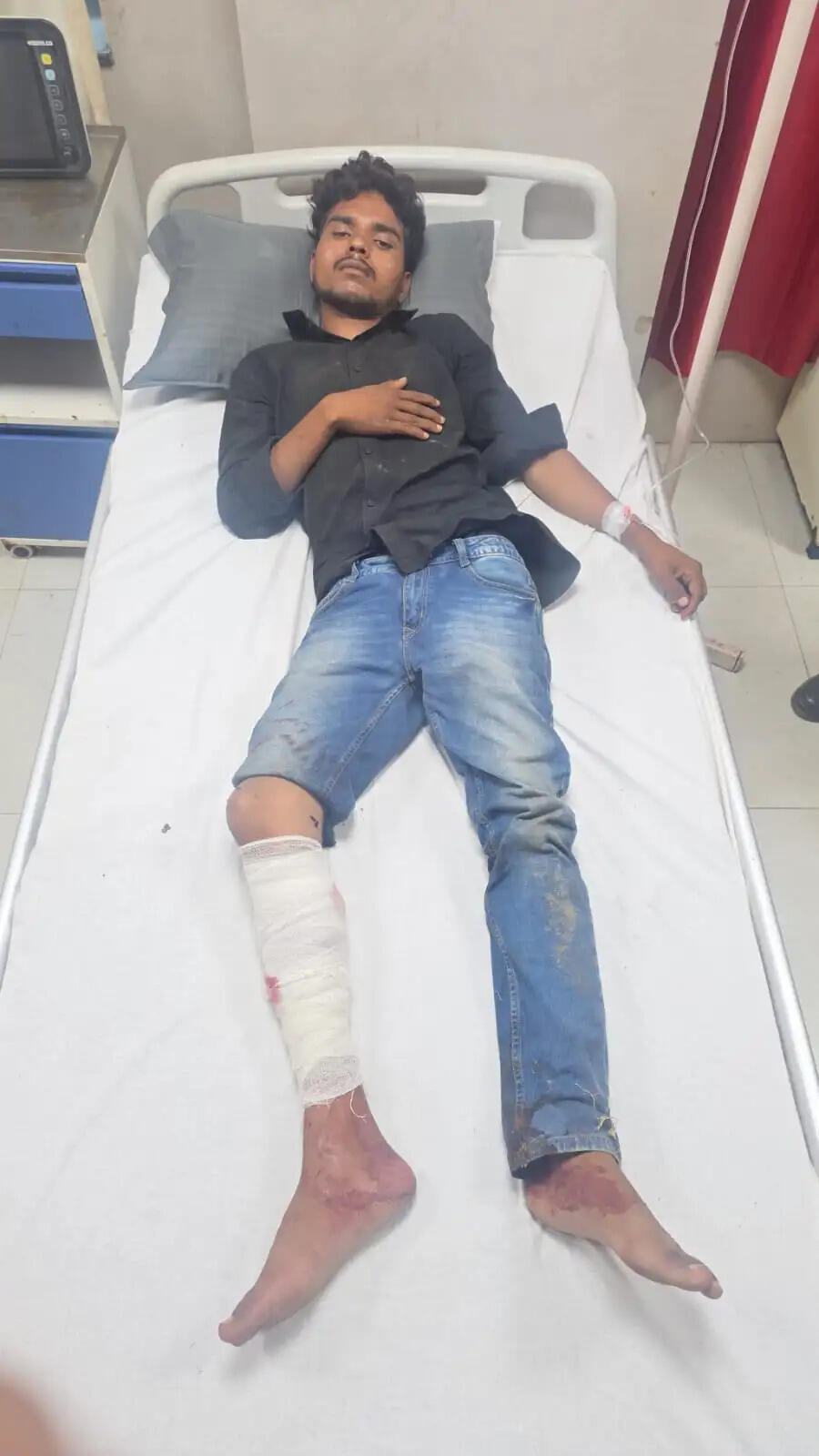 शराब सेल्समैनों से लूट करने वाले गिरोह के पांच आरोपित मुठभेड़ में गिरफ्तार, एक के पैर में लगी गोली