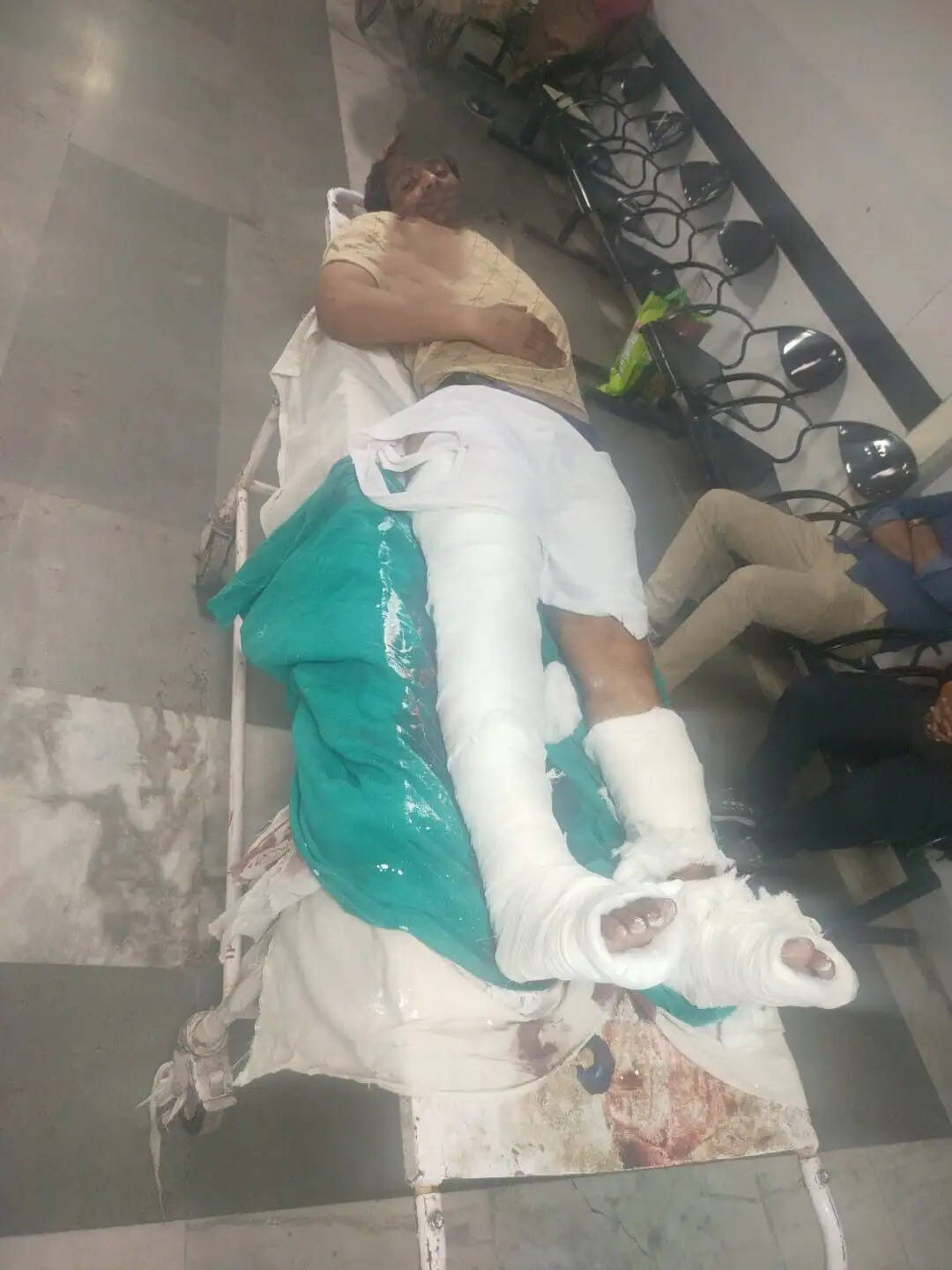 राेहतक : सत्यवान अपहरण व हत्याकांड में मुख्य आरोपी प्रदीप डागर व साथी मुठभेड़ के बाद गिरफ्तार