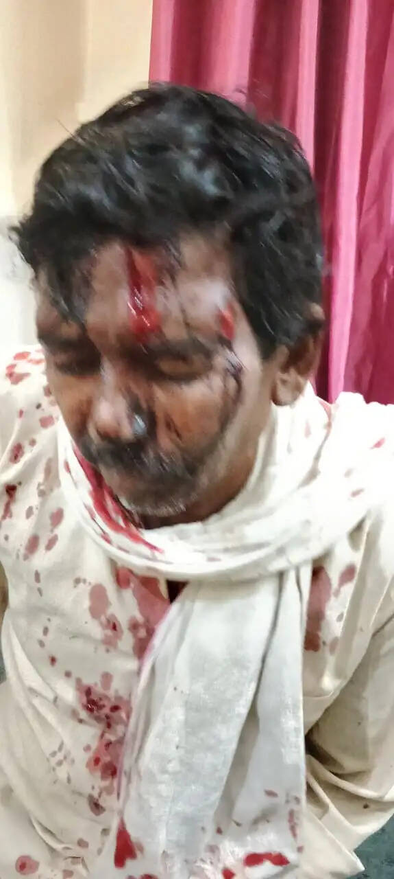 श्योपुरः वीरपुर के नहेलापुरा में जाटव-रावत समाज के बीच खूनी संघर्ष, लाठी-डंडो व कुल्हाड़ी से किया हमला