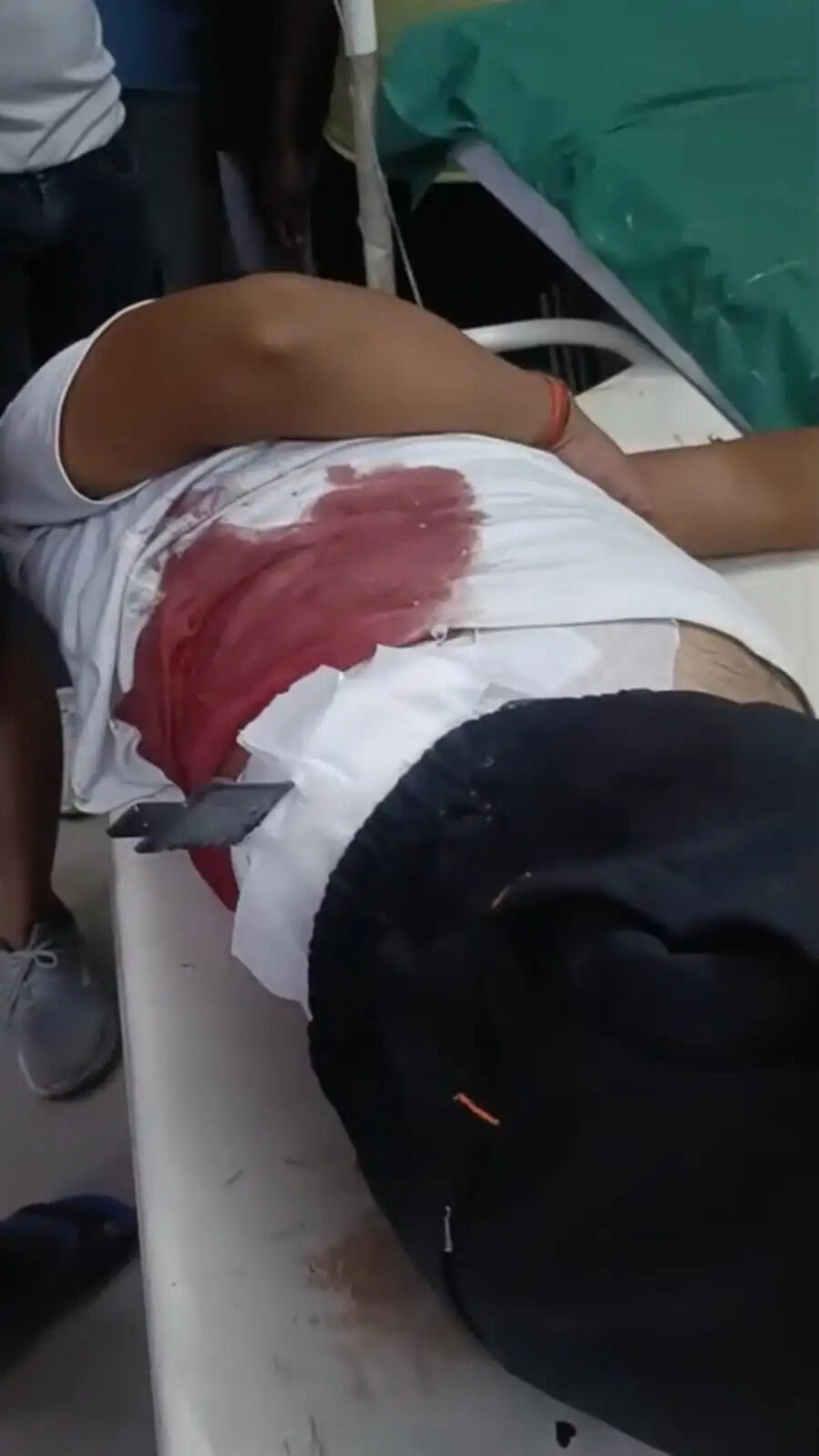 चुनावी रंजिश में युवक के पेट में चाकू घोंपा, हालत गंभीर