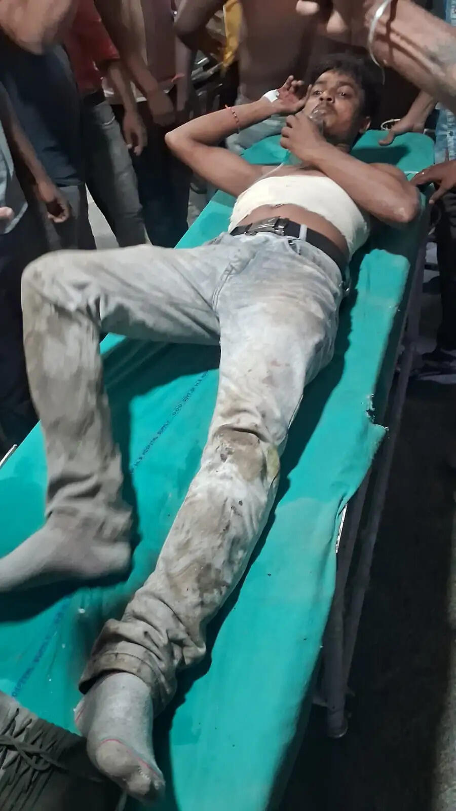 बशीरहाट में भाजपा कार्यकर्ता को मारी गोली, हालत गंभीर