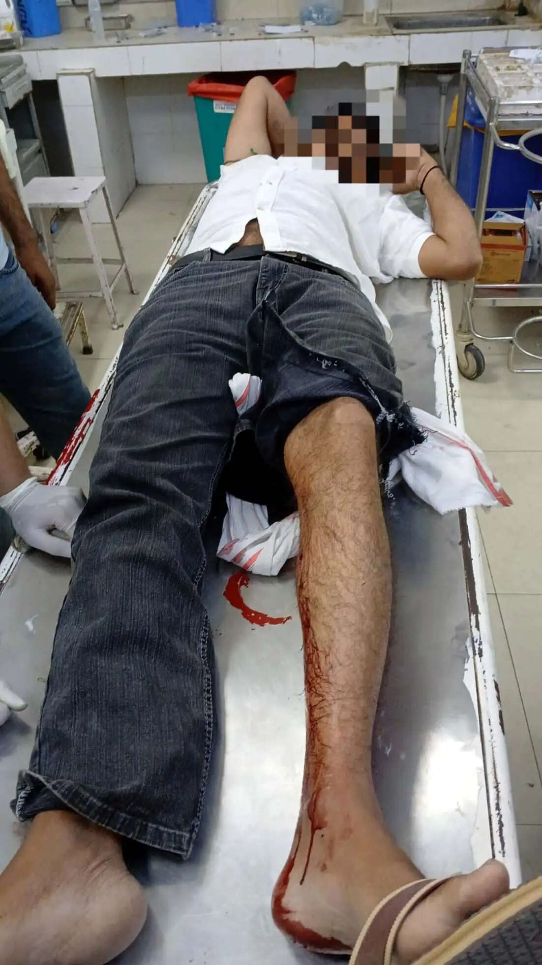 अपडेट ---हिसार में विनोद हत्याकांड के आरोपियों से पुलिस की मुठभेड़, दाे गिरफ्तार