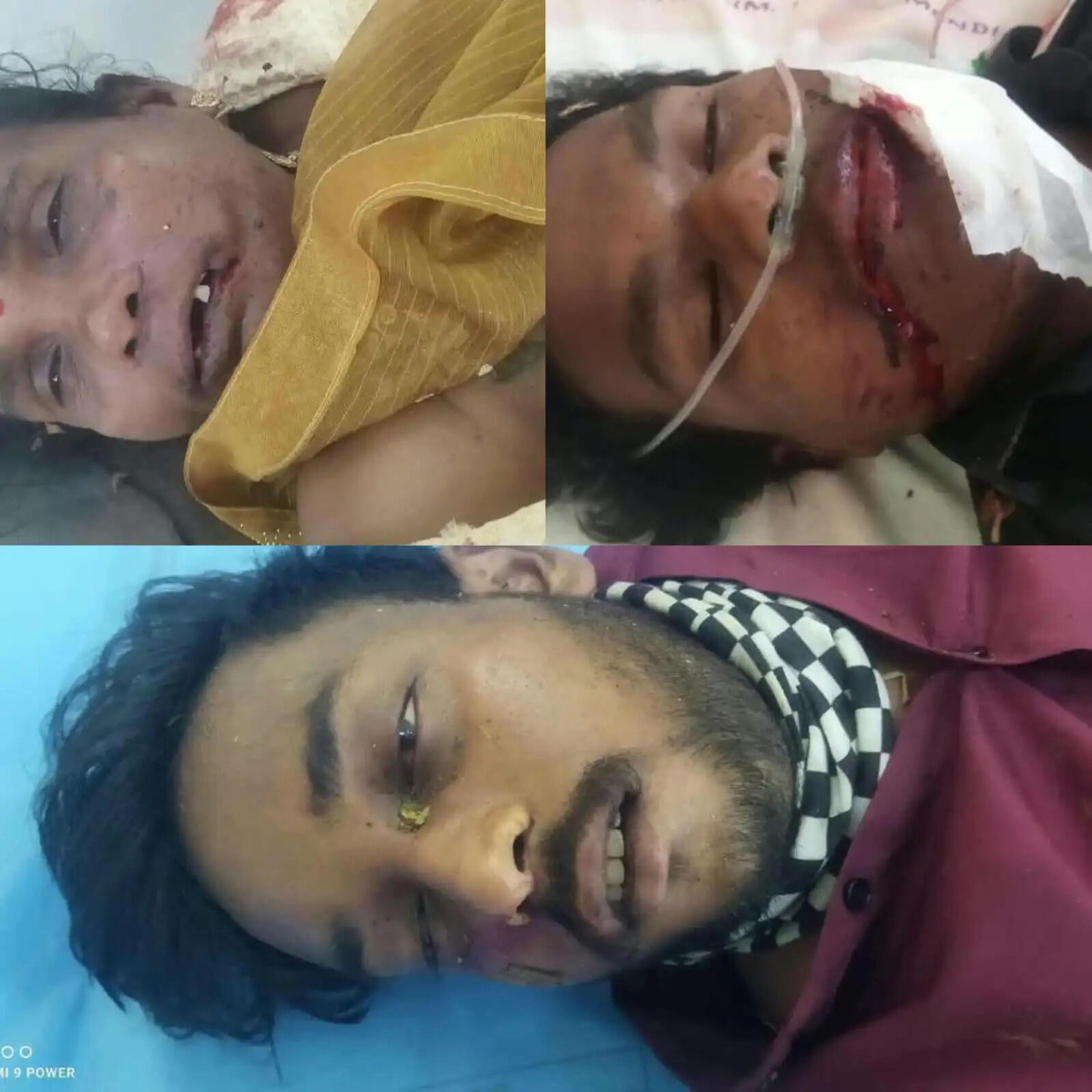 अनूपपुर: वाहन की टक्कर से पुल के नीचे गिरी बाइक, नानी-नाती की मौके पर मौत, पोते ने अस्पताल में तोड़ा दम