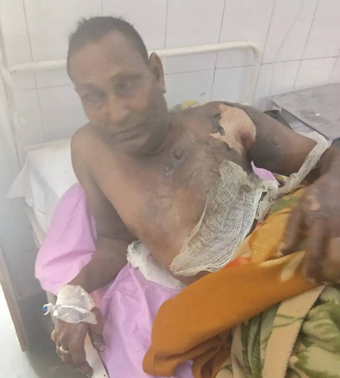 भदोही में बाप -बेटे पर लगा सगे भाई को पेट्रोल डालकर जलाने आरोप