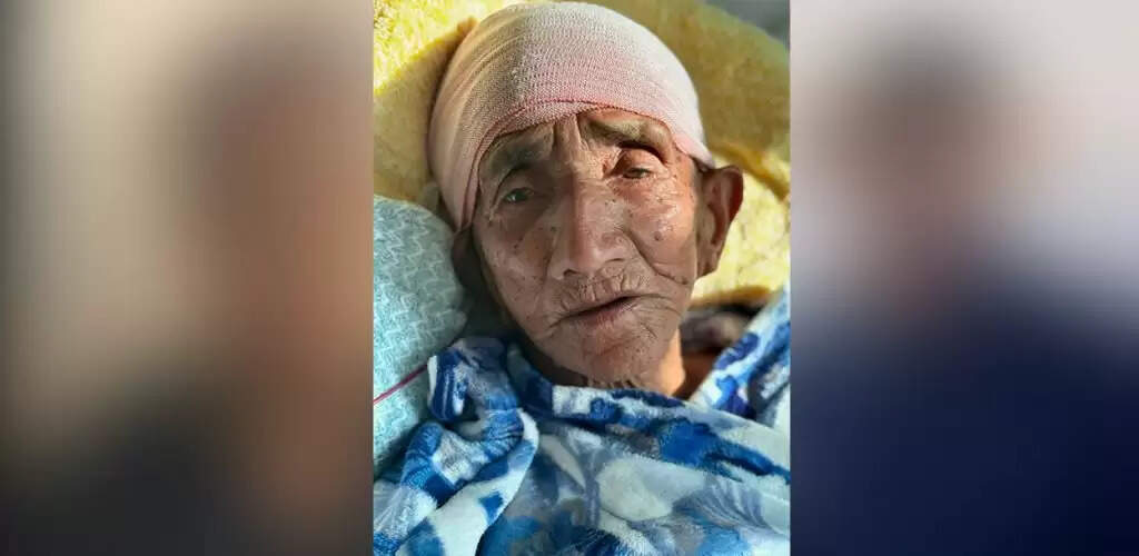 नेपाल में 103 वर्षीय वृद्धा&nbsp;के मस्तिष्क का सफल ऑपरेशन