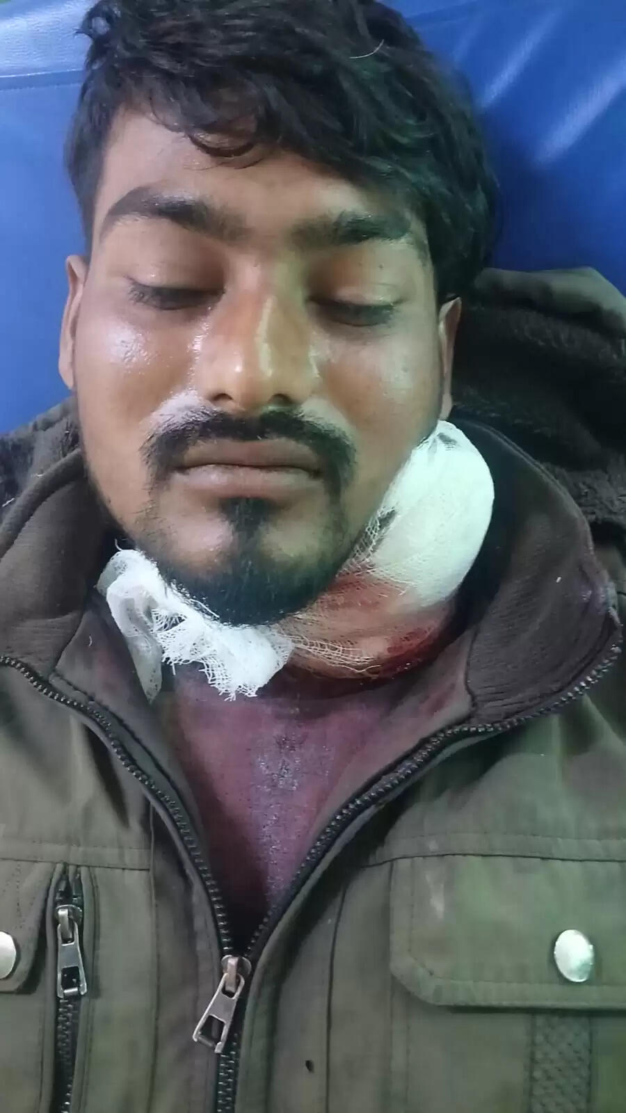 खाना मांगने पर पत्नी ने पति का चाकू से गला रेता