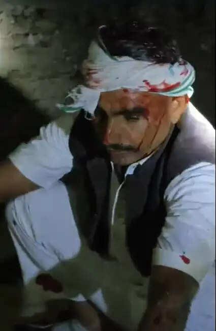 जाट महासभा के प्रदेशाध्यक्ष पर हमला, जोधपुर रैफर