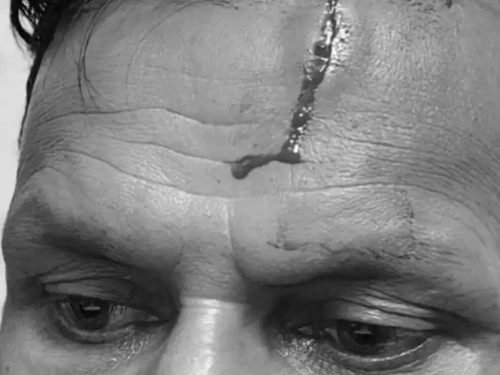 जेवरात चोरी की जांच के दौरान पुलिस टीम पर हमला, होमगार्ड जवान घायल