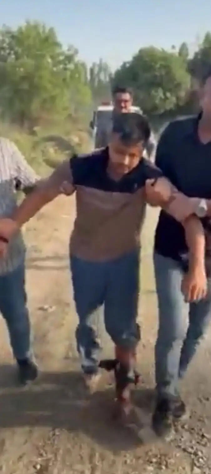 सूरत एसबीआई बैंक लूटकांड : हथियार बरामदगी के दौरान पुलिस पर फायरिंग, आरोपित के पैरों में लगी गोली