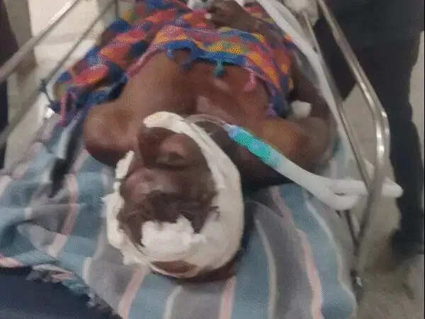 सीहोर में पट्टे के विवाद में किसान की हत्या, लाठी-तलवारों से घर में घुसकर हमला