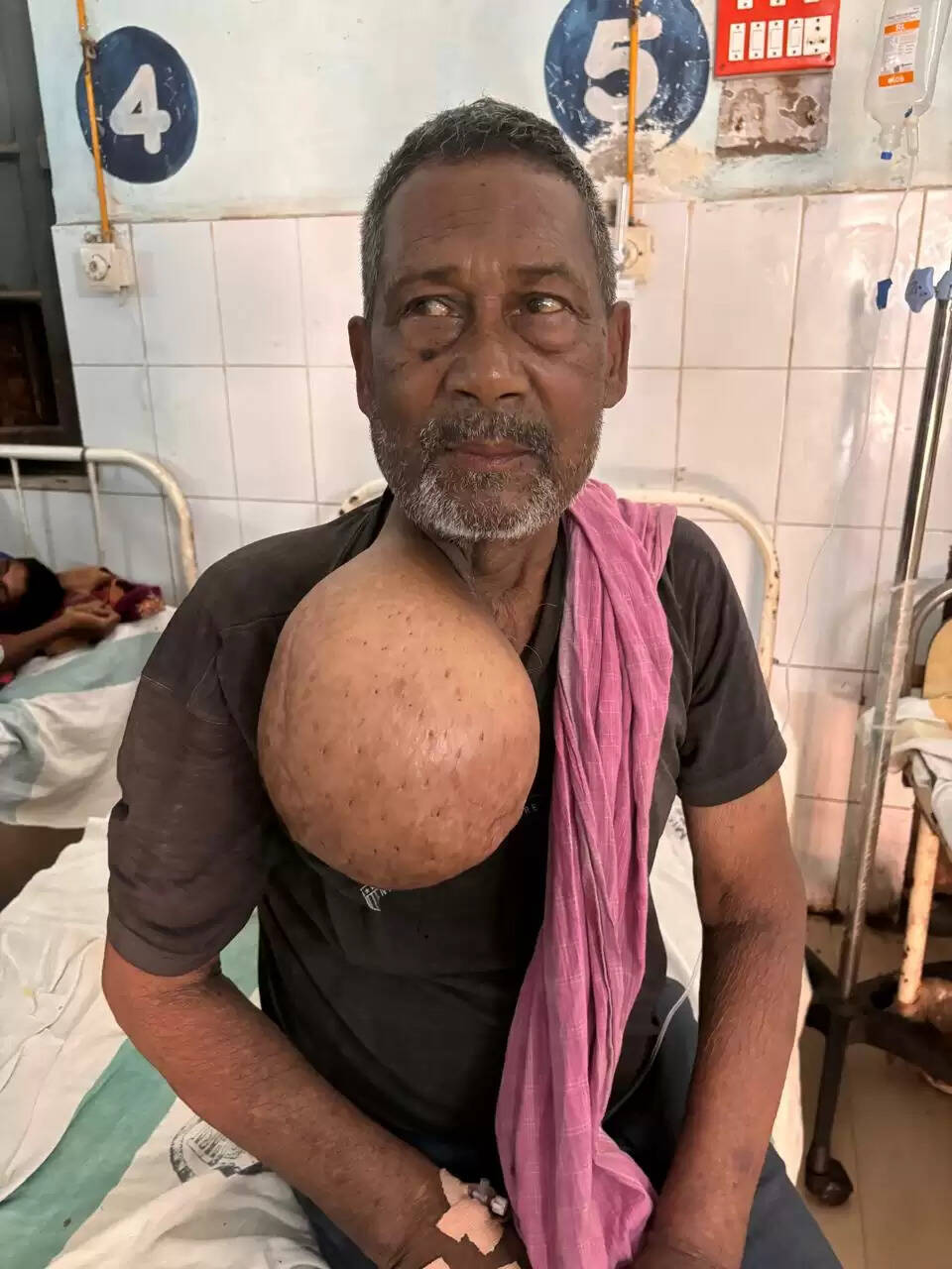 मानवता की मिसाल: गुरुदेव मुखिया का जीएमसीएच पूर्णिया में सफल ऑपरेशन