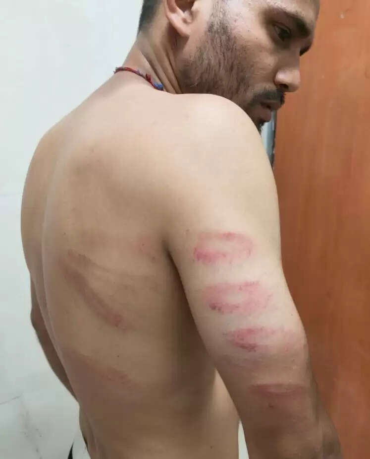 अमरनाथ यात्रा रजिस्ट्रेशन के दौरान युवक ने पुलिस पर मारपीट का लगाया आरोप