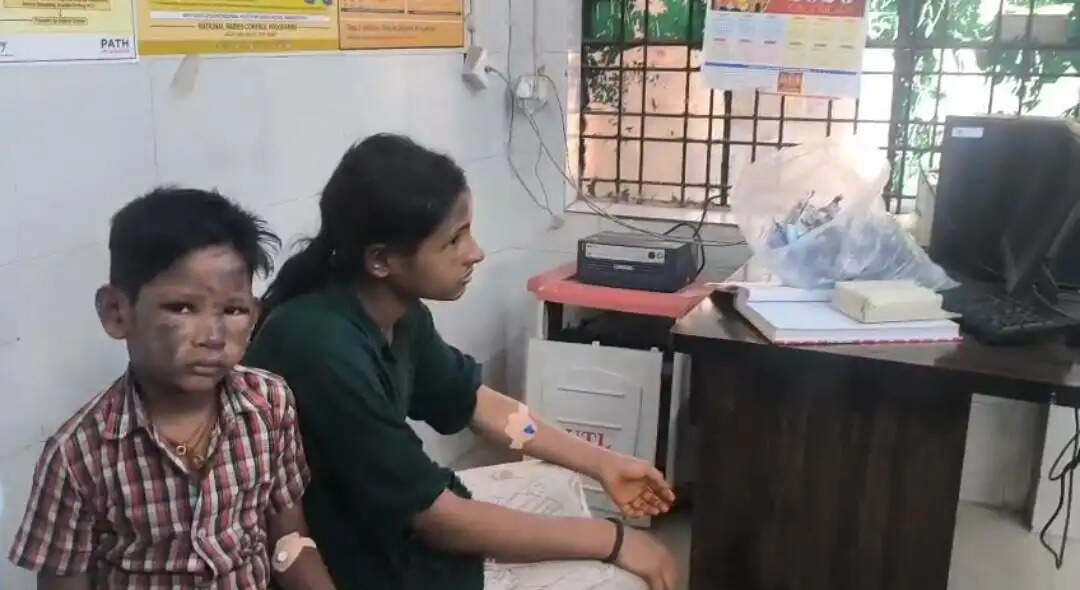 जौनपुर में रसाेई गैस सिलेंडर का रेगुलेटर बदलते समय हादसा, पांच झुलसे