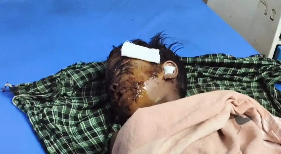 लेमरू में झरने के पास भालू का हमला, 13 वर्षीय बच्चे को किया घायल