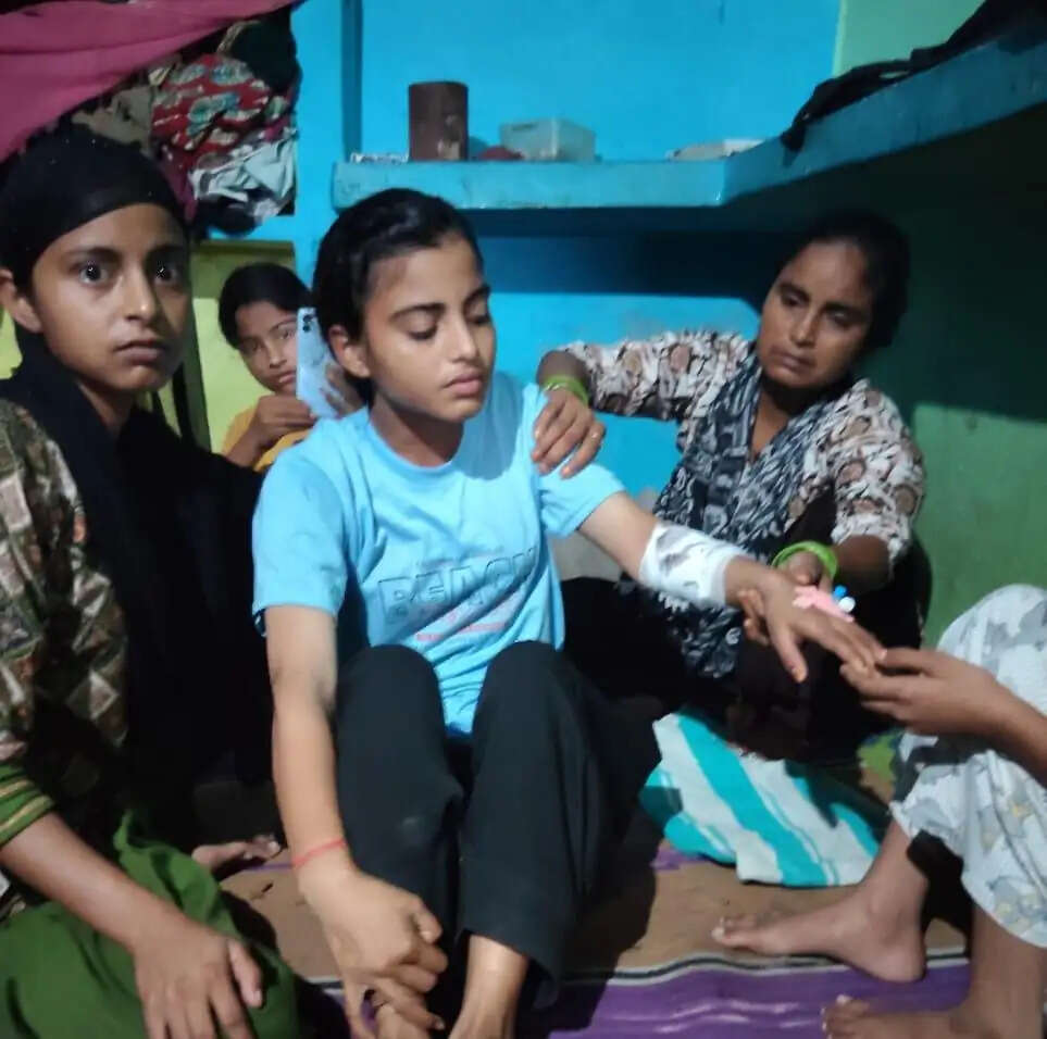 बंदरों के हमले में किशोरी घायल