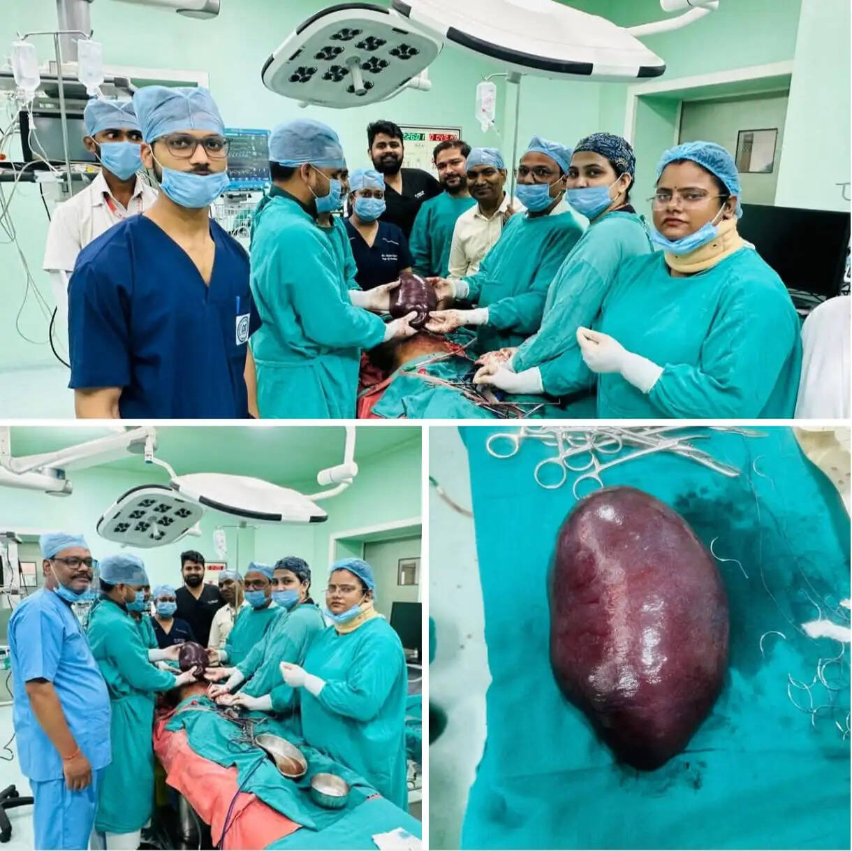 देवराहा बाबा मेडिकल कॉलेज में वृद्ध महिला का जटिल ऑपरेशन सफल