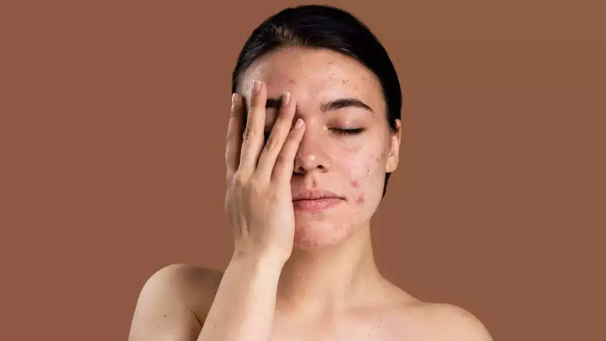 बीकानेर में 24 अक्टूबर से जुटेंगे देश-विदेश के चर्म रोग विशेषज्ञ