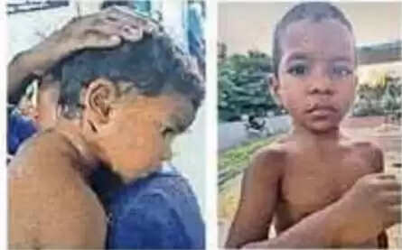 बलरामपुर : रामानुजगंज में पागल कुत्तों का आतंक, कलेक्टर ने दिए नगरपालिका को उचित कदम उठाने के निर्देश