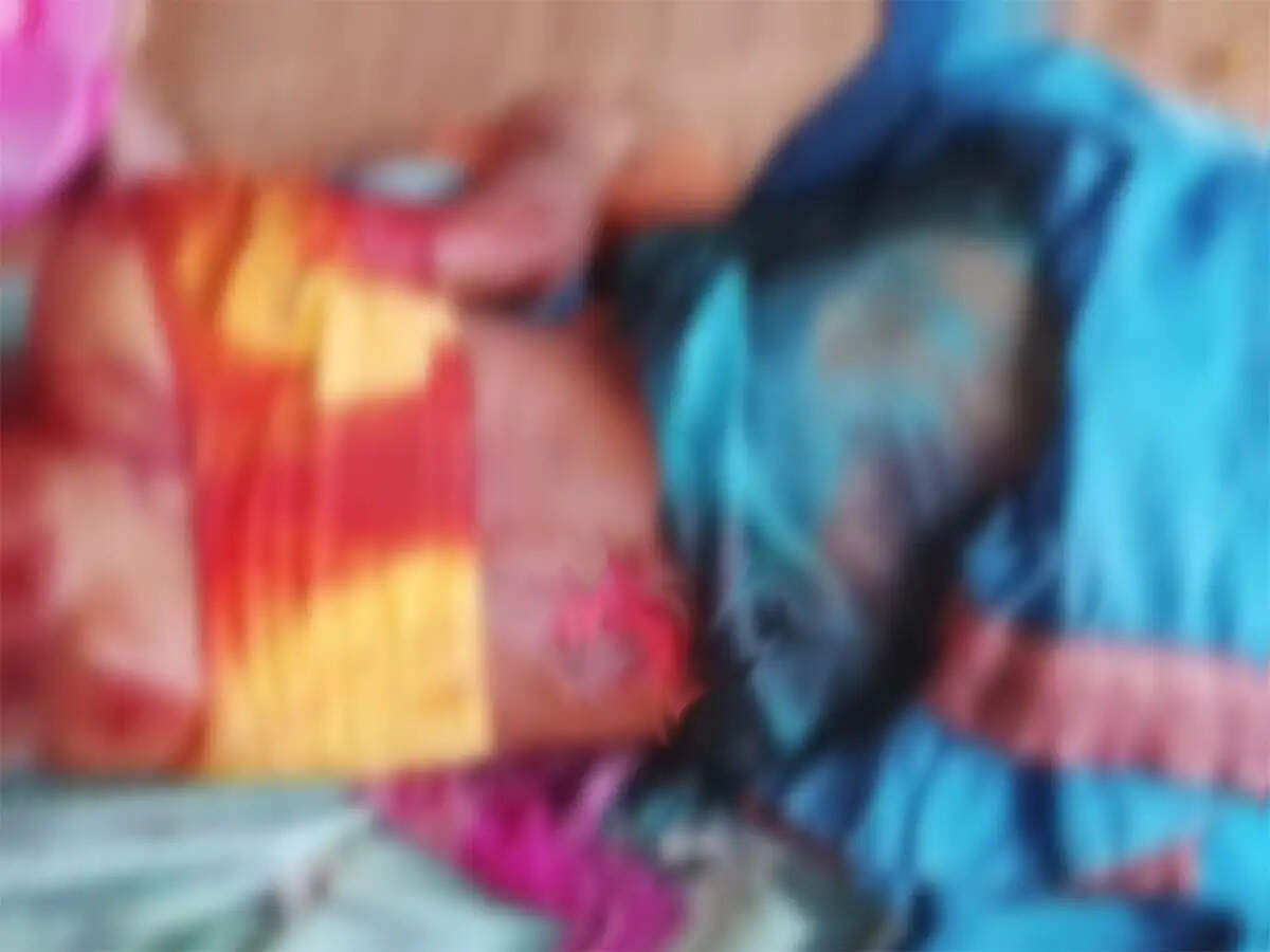 सूरजपुर : जंगल में खुखड़ी-पुटू बीनने गई महिला पर तीन भालुओं का जानलेवा हमला